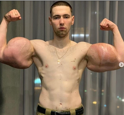 الرجل ذو العضلات المزي