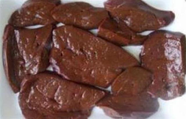 كبدة فاسدة