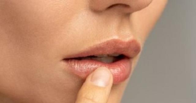 علاج تشقق الشفاه 