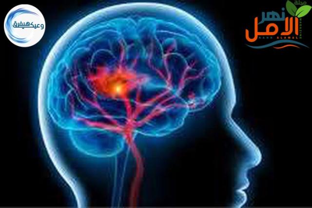 صورة
