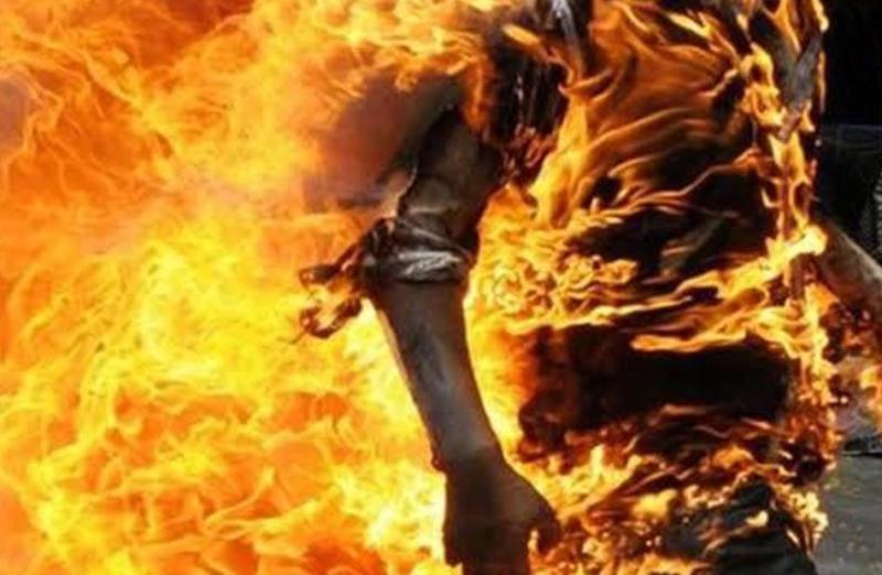 حرق شخص - أرشيفية
