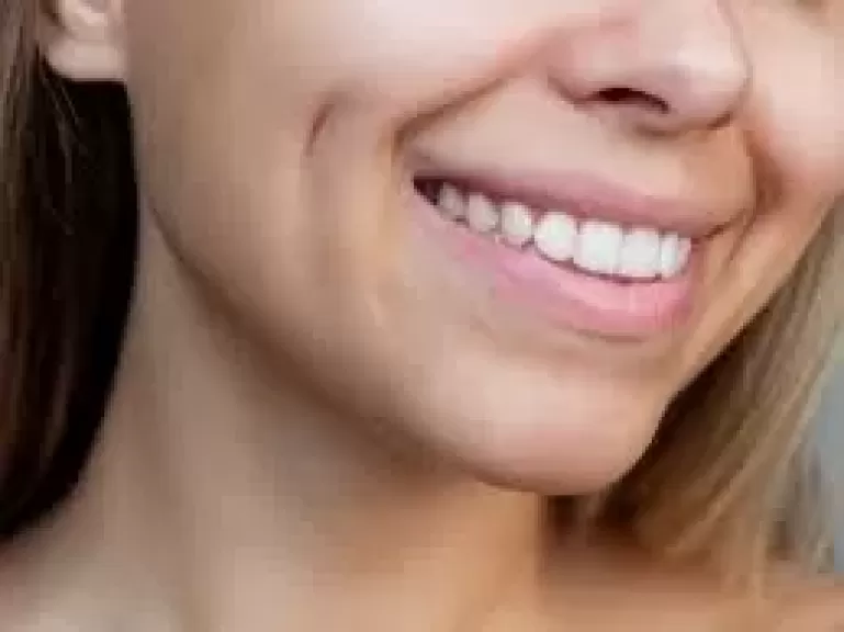 غمازات