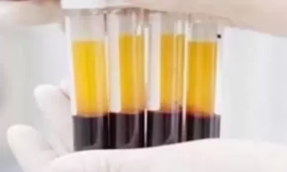 مشتقات البلازما