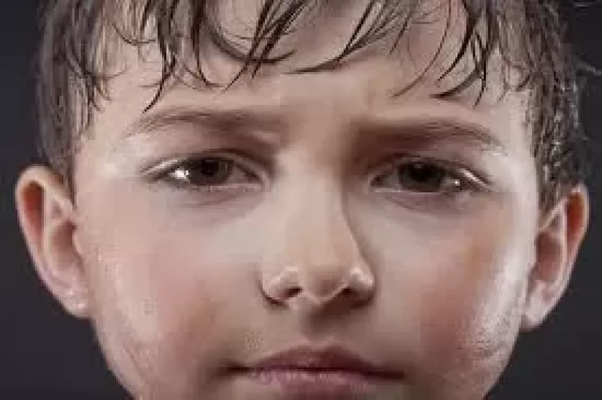 التعرق