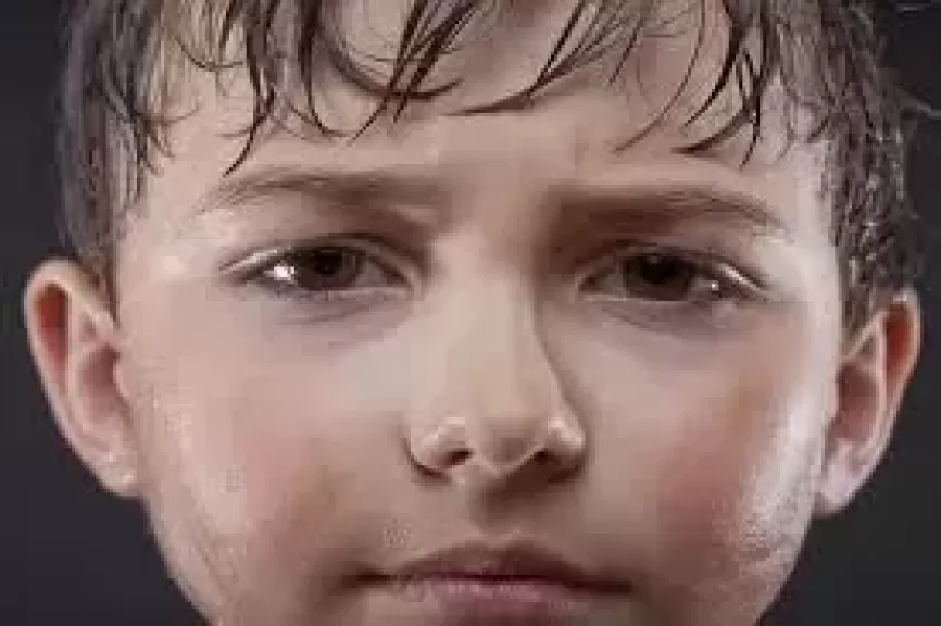  البثور 