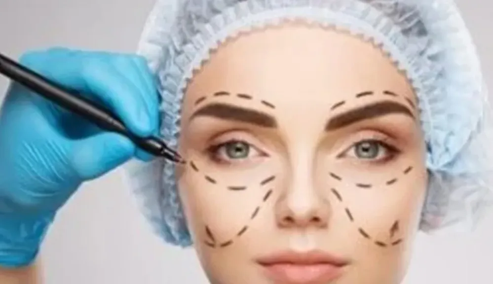 عمليات التجميل 