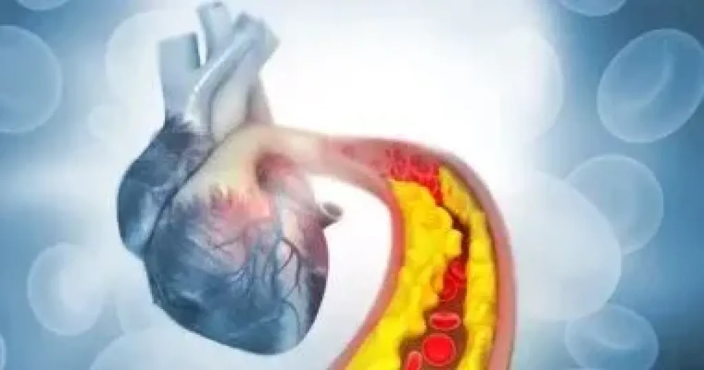 نصائح لخفض الكوليسترول السيئ بالجسم