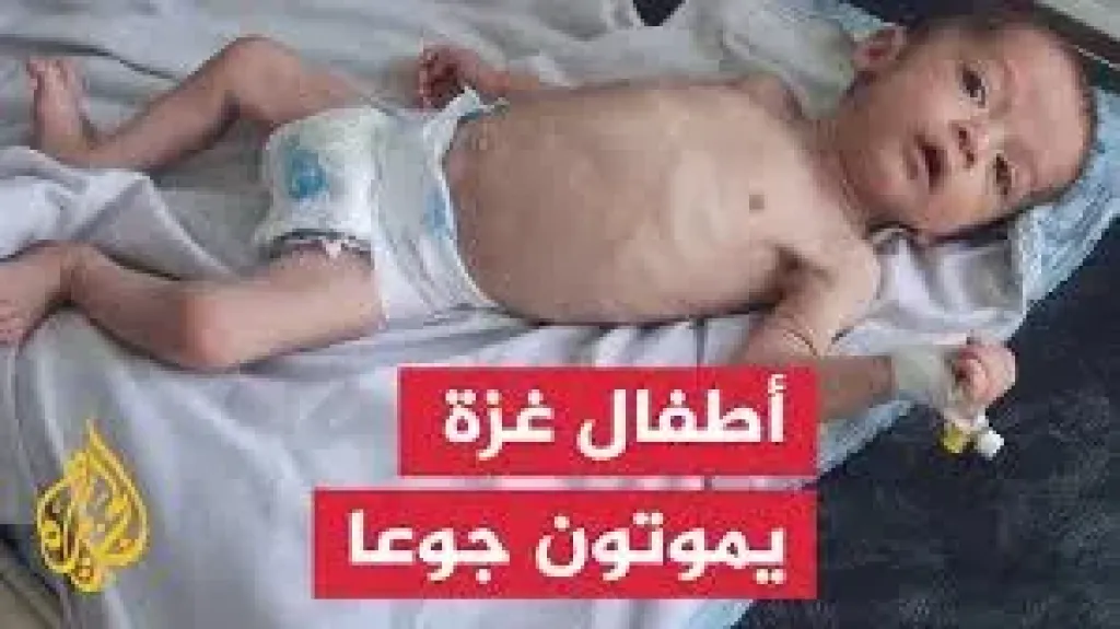 موت اطفال غزه جوعا