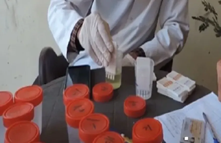  إجراء فحص المخدرات - أرشيفية