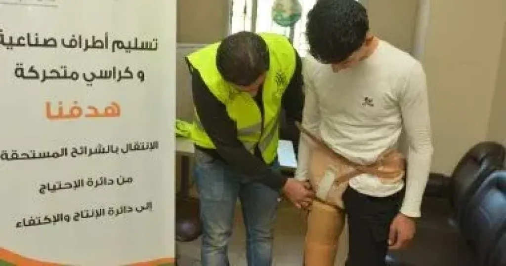 تركيب طرف صناعي