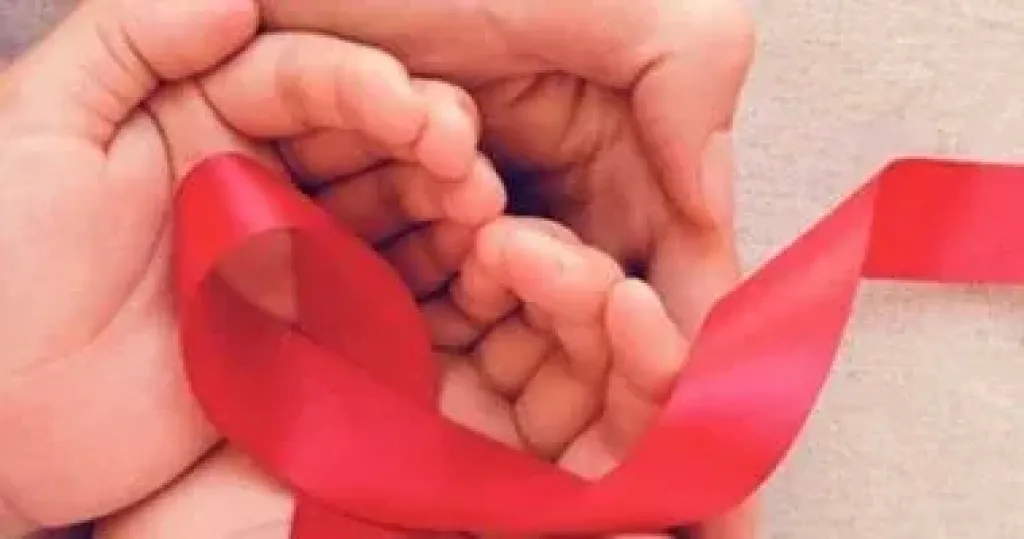 الايدز