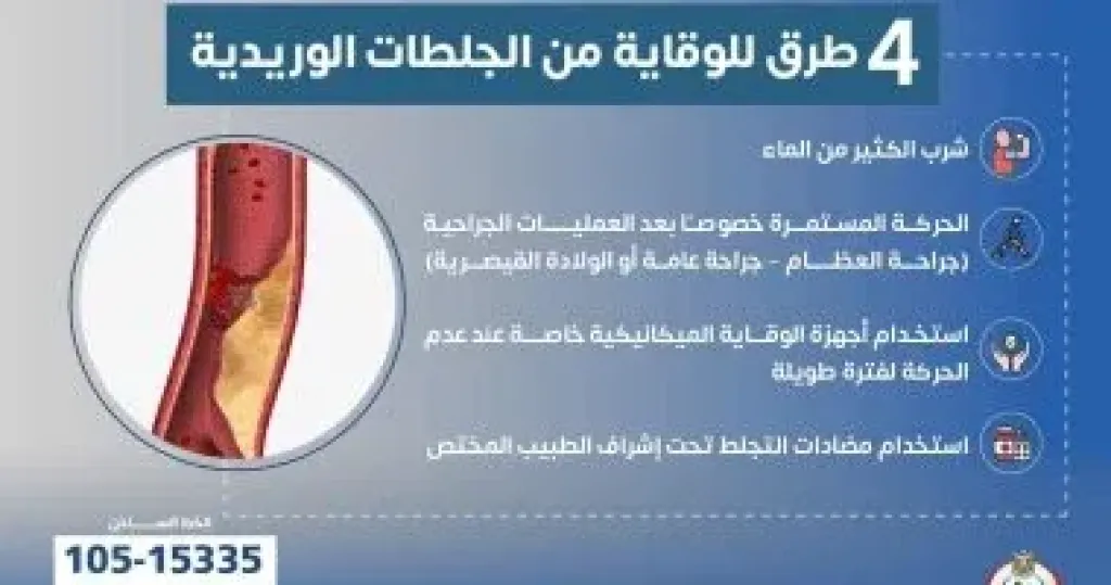 4 طرق للوقاية من الجلطات الوريدية