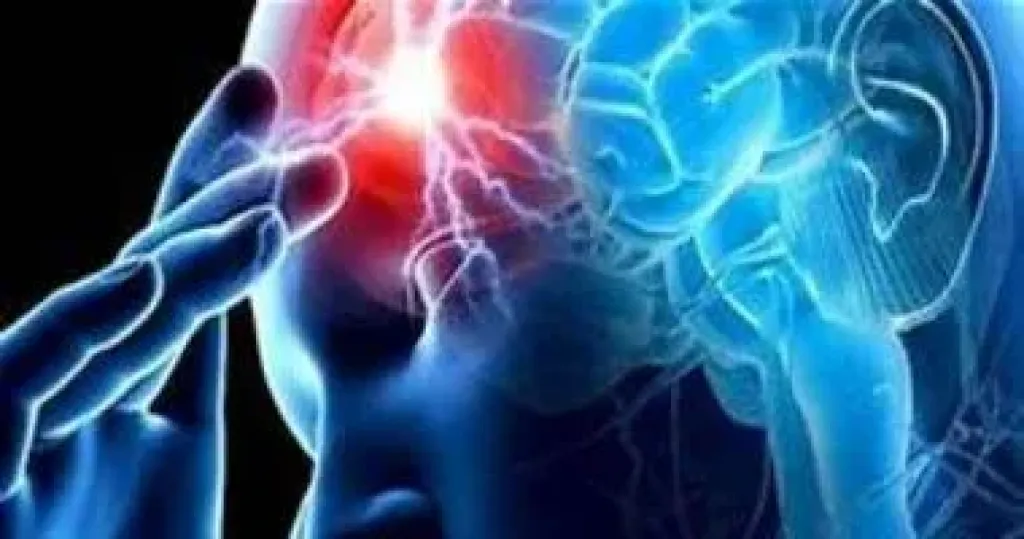 تحفيز الدماغ لعلاج الصرع