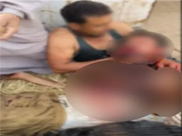 الحادث