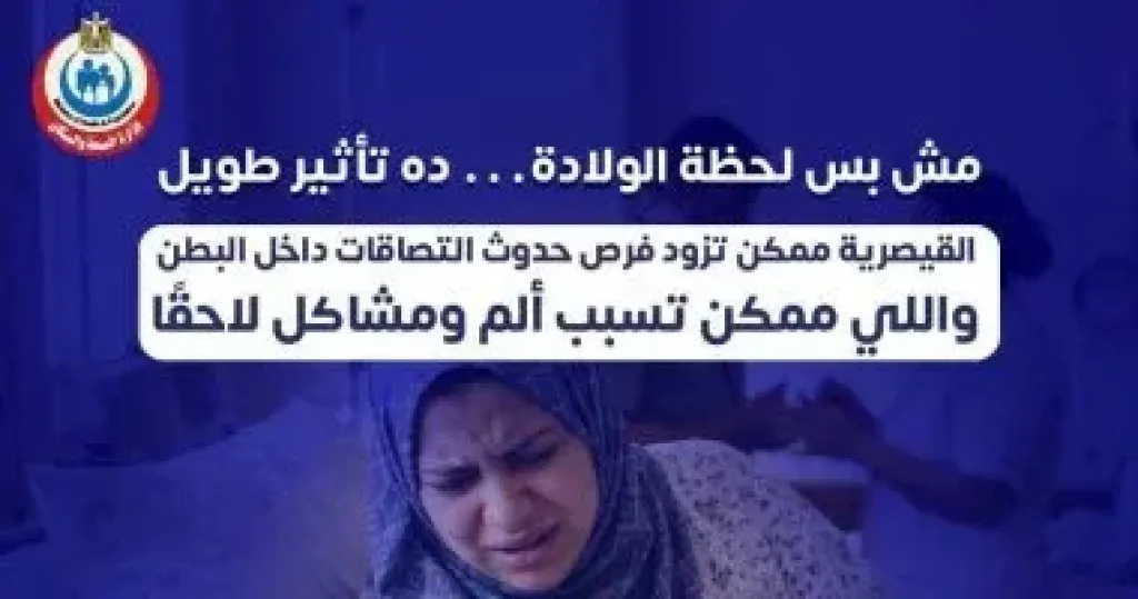 وزارة الصحة تحذر من الإفراط في الولادات القيصرية
