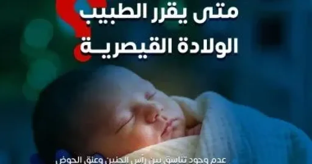 الولادة القيصرية 