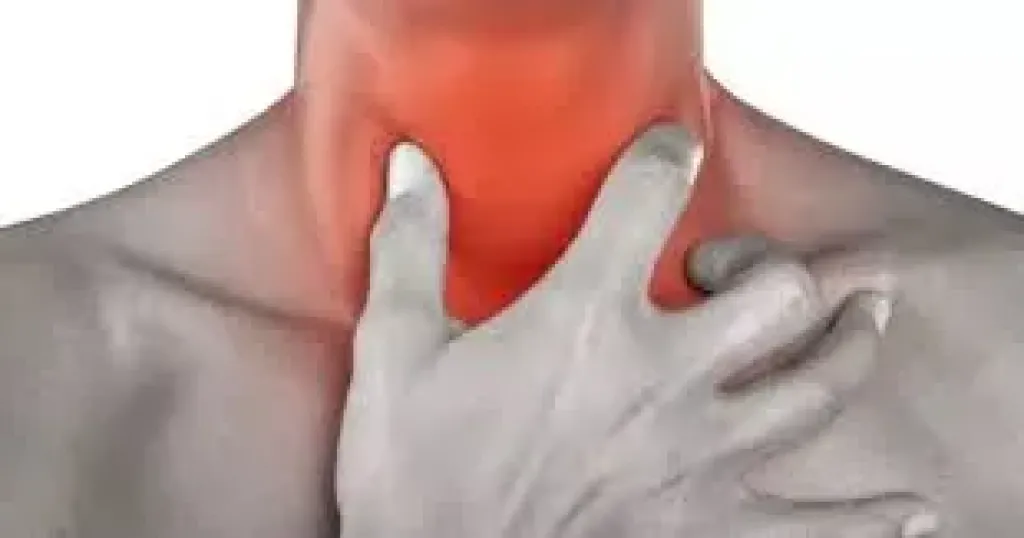 التهاب الحلق