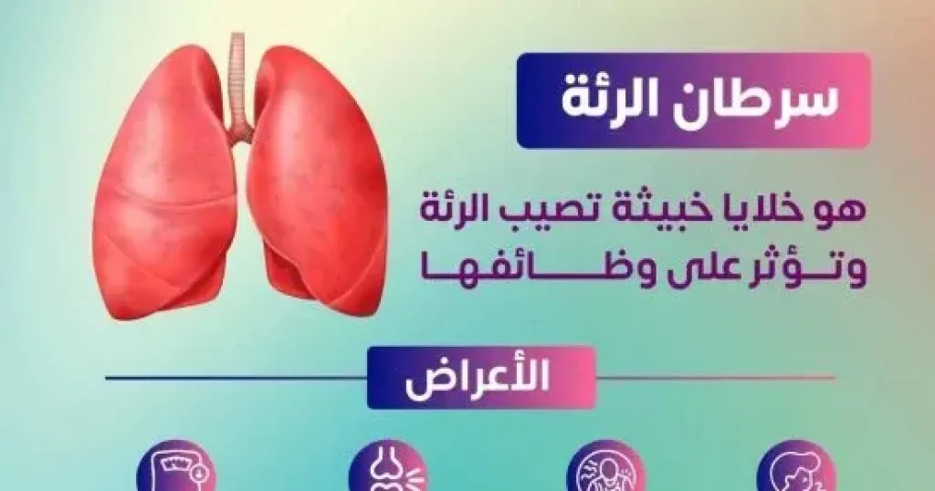  سرطان الرئة  